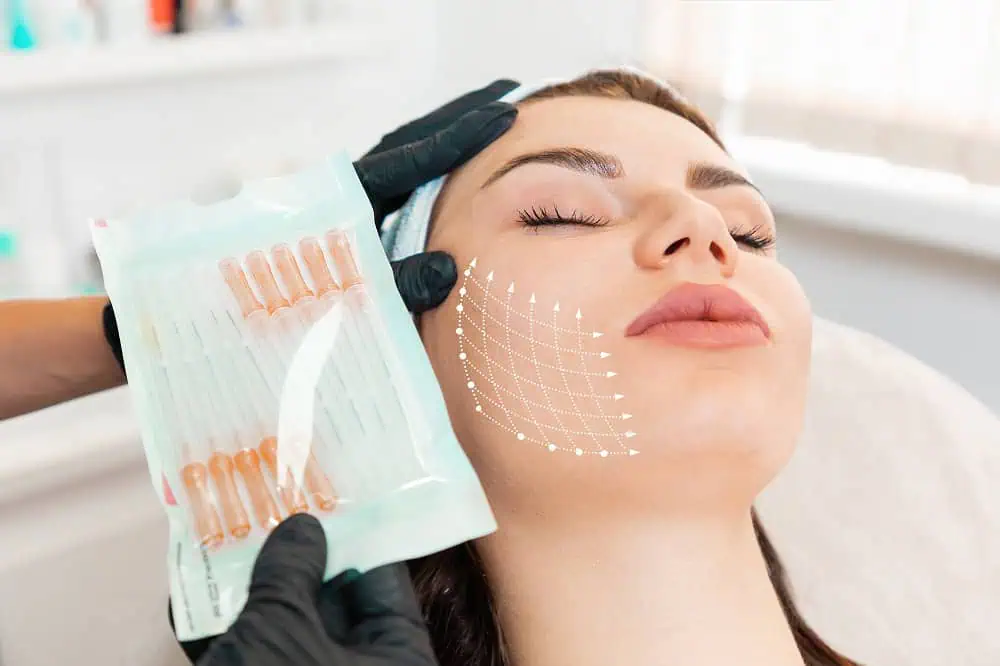 Woman Getting MINT™ PDO Barb Lifting Treatment in Beverly Hills, CA | Maven Medispa