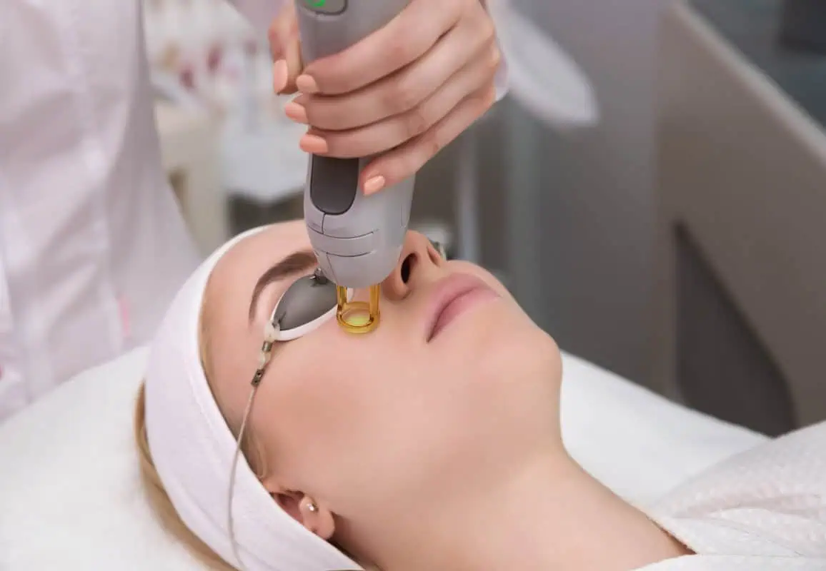 CO2 Laser Resurfacing by Maven Medispa in Beverly Hills, CA