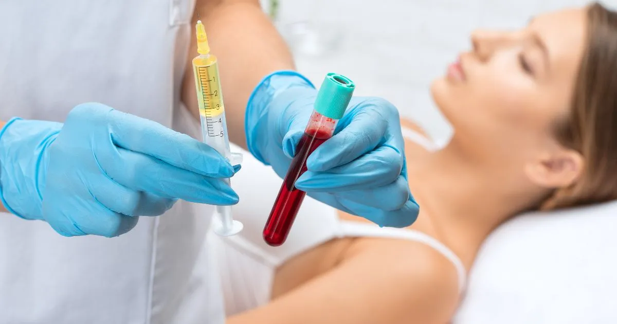 EZ GEL Bio Filler procedure prep in Beverly Hills with blood draw and syringe