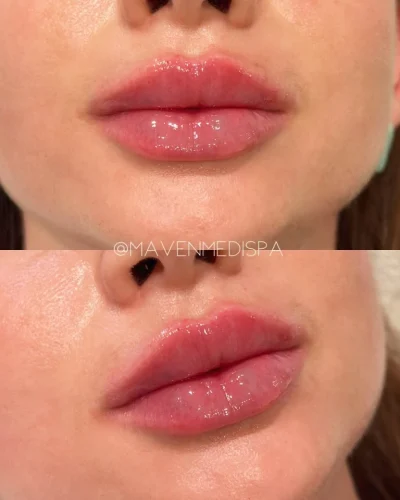 medspa-gallery-zd