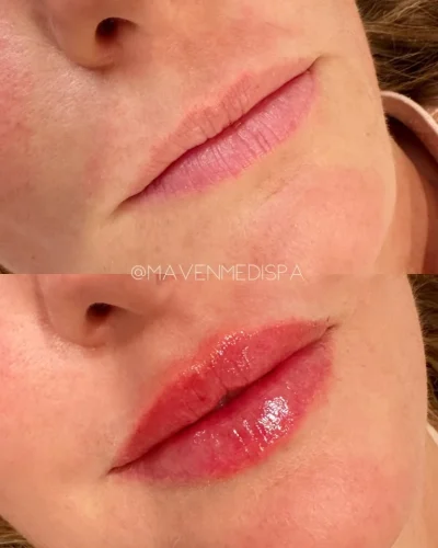medspa-gallery-ze
