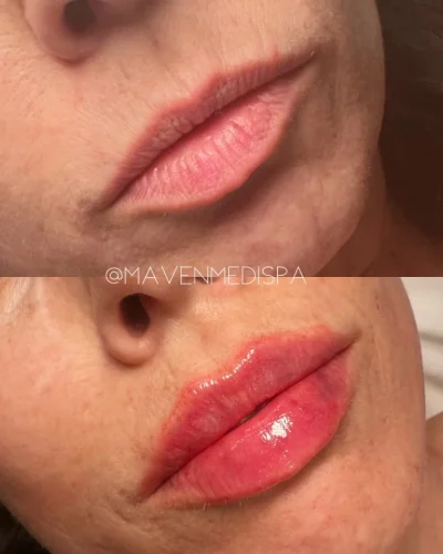 medspa-gallery-zj